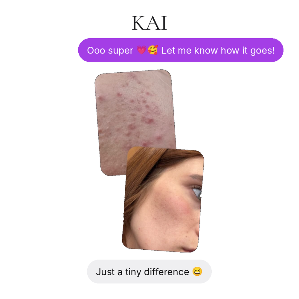 KAI Sea Moss Gel