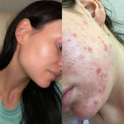 Irisches Sea Moss Gesichts- & Haarmaske